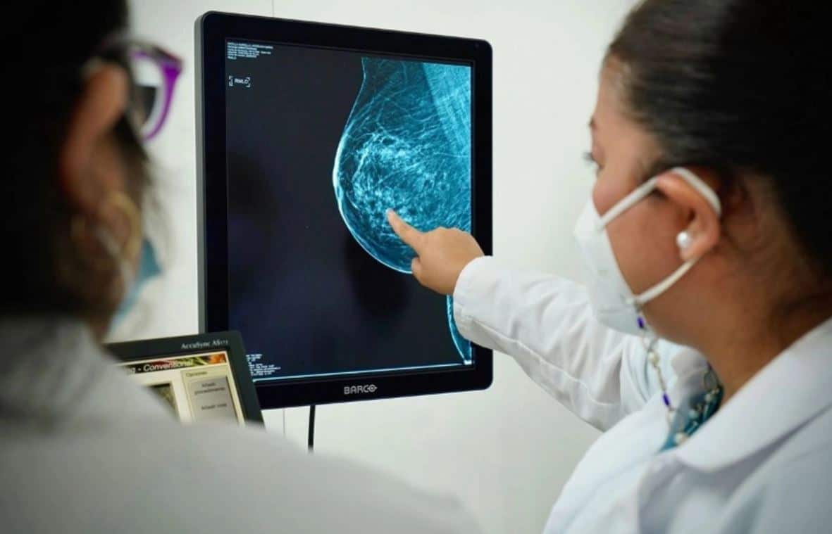 Llegan tarde a detectar c&aacute;ncer de mama