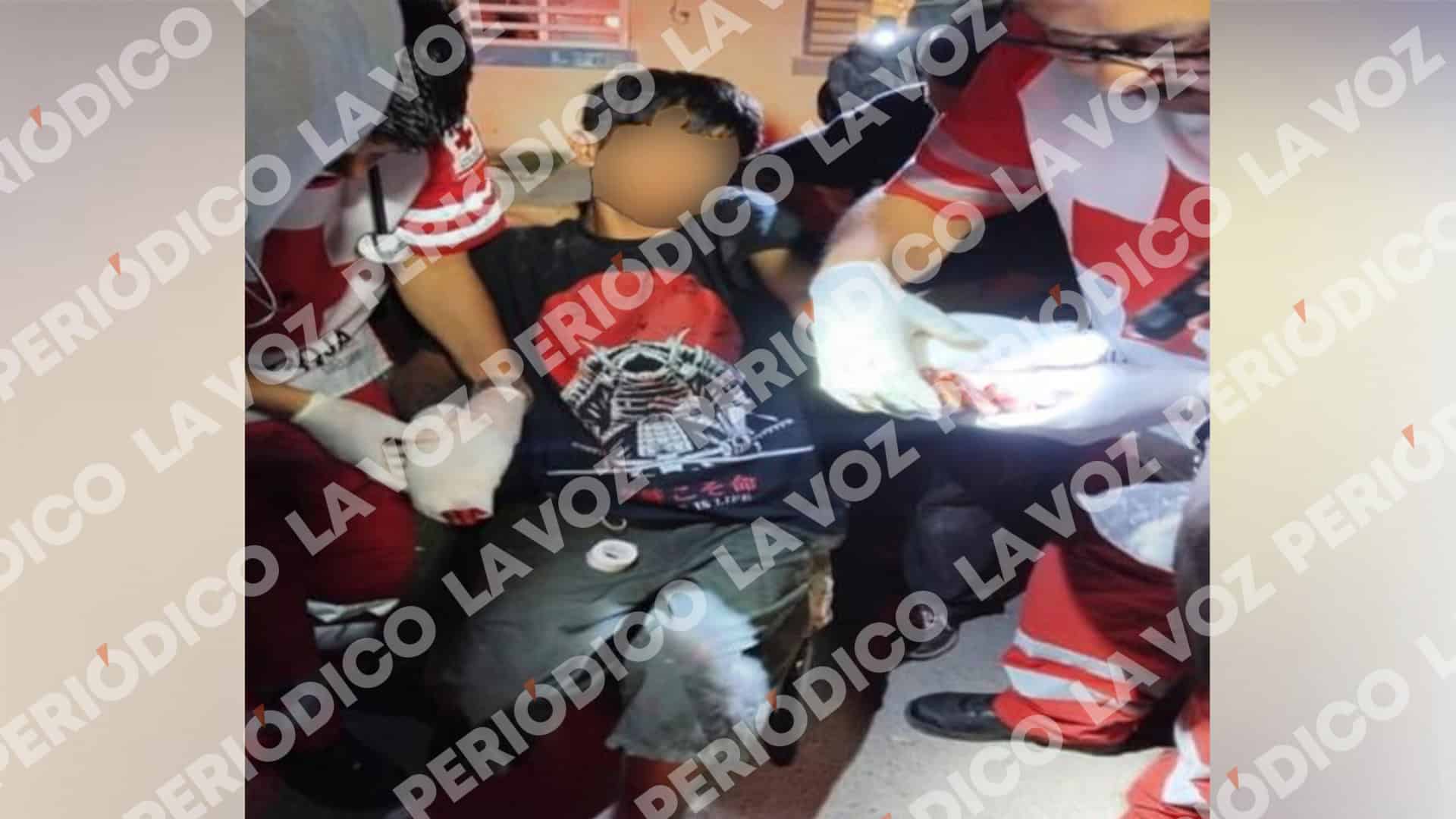 Joven sufre lesiones en manos tras asalto en Frontera