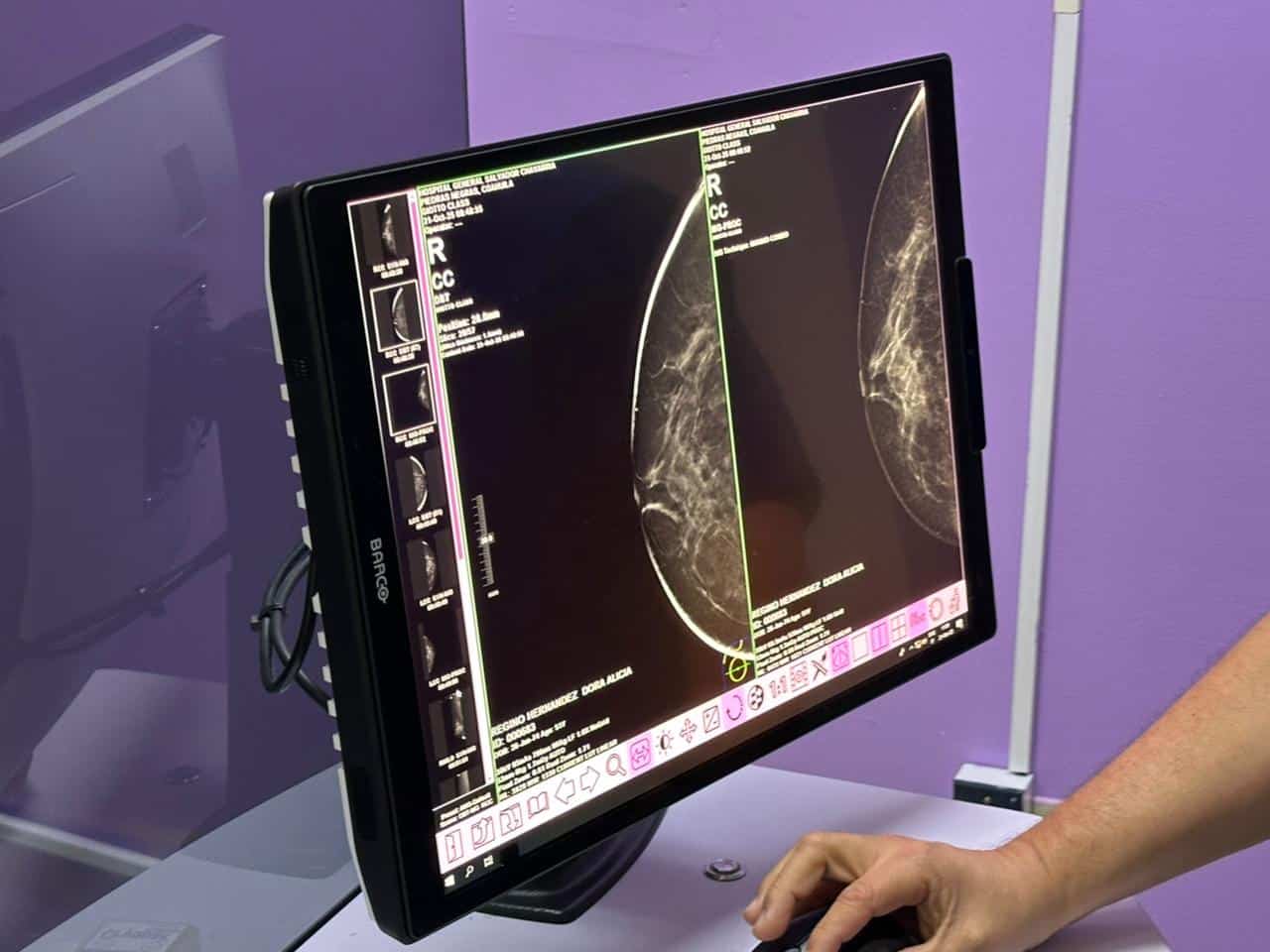 Ampl&iacute;a Hospital General Dr. Salvador Chavarr&iacute;a detecci&oacute;n de c&aacute;ncer mamario